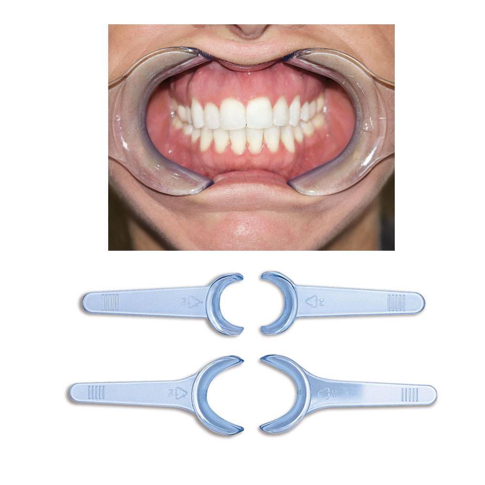 Photo Cheek Retractor