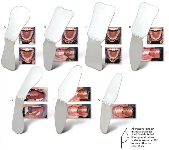 Intraoral Stainless Steel Photographic Mirrors