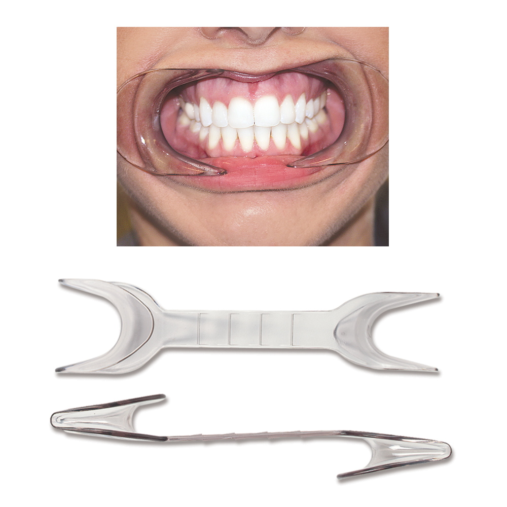 Photo Cheek Retractor Double EndedAutoclavable