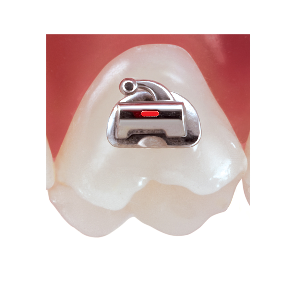 First (6) Molar Buccal Tubes